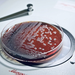 Лаборатория преодоления микробной резистентности